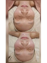 ロータスマップ(LOTUS MAP)/