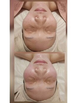 ロータスマップ(LOTUS MAP)/