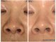 ウカ(uka)の写真