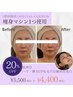 【肌弾力×美白】全顔施術◎お肌のハリUPで毛穴引締め♪リフトUPセラム付