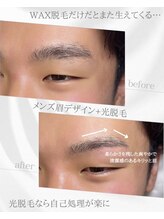 リノア(Linoa)/メンズ眉毛ビフォーアフター