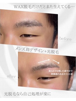リノア(Linoa)/メンズ眉毛ビフォーアフター
