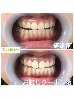 ルブラン 奈良店(Le Blanc)/毎月先着15名様限定フリーパス