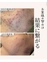 アネラ(Anela)/努力した分、結果が出る！