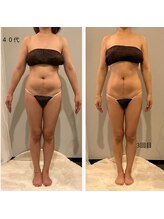 ソウソウビューティー 五反田(Shou Shou Beauty)/EX＋リンパマッサージ