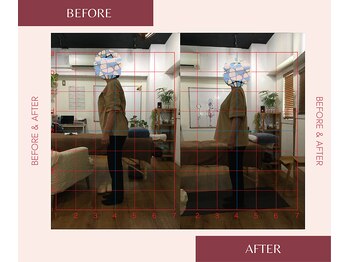 整体院 來花 福岡薬院店(KOHANA)/慢性腰痛のお悩み