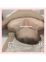 ヨリーズサロン(yoris.salon)/あの頃に戻りたい★フェイシャル