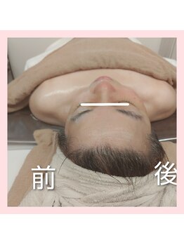 ヨリーズサロン(yoris.salon)/あの頃に戻りたい★フェイシャル