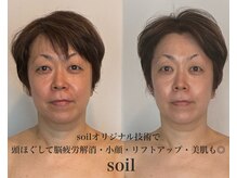 ソイル(Soil)の雰囲気(一目瞭然!浮腫み減・トーンUP・リフトUP全身巡らせて流す◎)