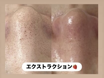 ラヴィ(Ravi)の写真