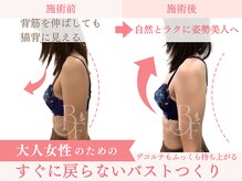 ベルフルール/猫背が気になる方へ/熊本/南熊本
