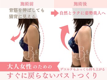 ベルフルール/猫背が気になる方へ/熊本/南熊本