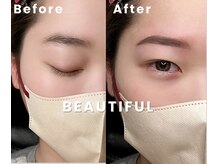 アリイ(Alii)/Beautiful