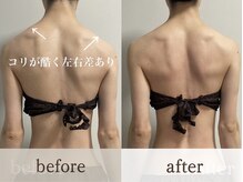 アイビー(ivy)/肩の左右差　before/after