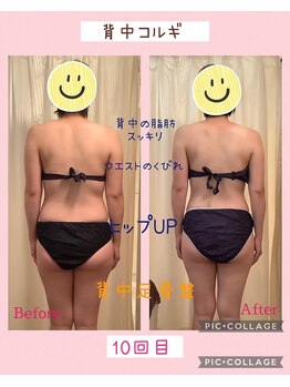 小顔コルギ専門店 フェルーシュ 成田駅前店(Feruche)/背中足骨盤