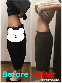 美容整体ユメカ(美容整体YUMEKA)/骨盤ダイエット+骨盤ストレッチ