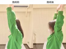 名古屋栄 肩こり腰痛専門整体 らーく/お客様のbefore、after