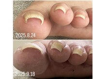 ケア ビューティー ネイル(care beauty NAIL)/