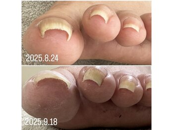 ケア ビューティー ネイル(care beauty NAIL)/