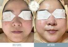 スナグル(Snuggle)