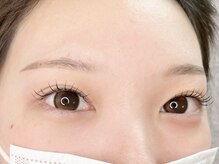 アイアム(eyeam)/フラットラッシュ100+&ヘルシー