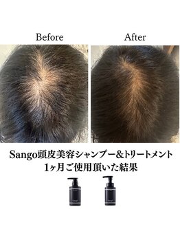 ララスマイル 鶴崎森町店/美髪頭皮ケアプログラム