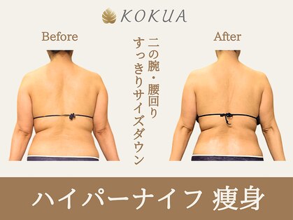 痩身専門店エステティックサロン コクア(KOKUA)の写真