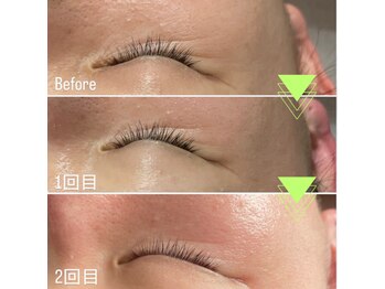 ステラ(STELLA)/【敏感肌OK】ラミピール