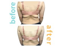 シエル(Ciel)/バストアップ施術１回