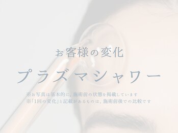 ラシック 加古川店(La chic.)/毛穴の開き・くすみを集中ケア