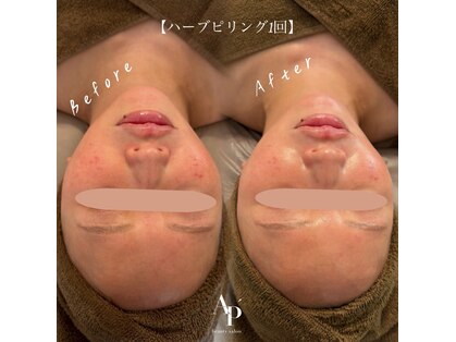 アピュルテ(A purete')の写真
