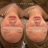 アピュルテ(A purete')