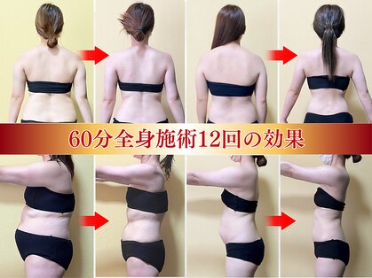 ビジュクイーン(BIJOU QUEEN)の写真