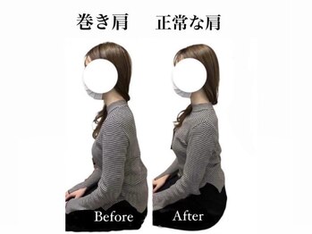 ハリカ 大阪心斎橋店(HARIKA)/施術効果抜群!巻き肩と肩こりに