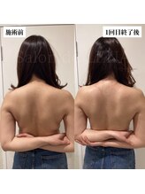 ラバ 名古屋栄店(LAVA)/どの角度から見ても美しい背中へ