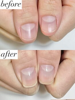 ニコワイズネイル(Nico Y's Nail)/【自爪育成コース】