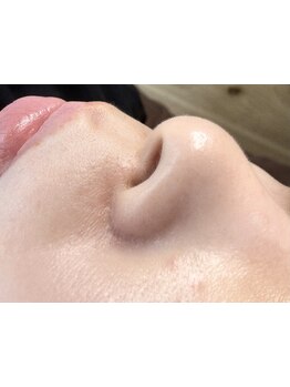 毛穴ケアをしたい