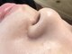 ルポ(repos)の写真/【毛穴レス陶器肌に♪】お悩みに合わせてぴったりのケアをご提案♪毛穴角質ケア/肌トーン・キメUPに◎