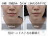 人気No1癒し&疲れ顔むくみ解消《ヘッドスパ＋肩こり＋小顔矯正》80分小顔整体