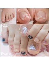 エッセンス (Essence)/親指のトラブル爪補修＋ネイル