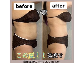 クチュール(couture.)/痩せたい部分を集中施術