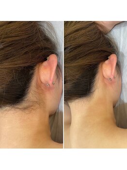 インベスト(INVEST)/うなじ