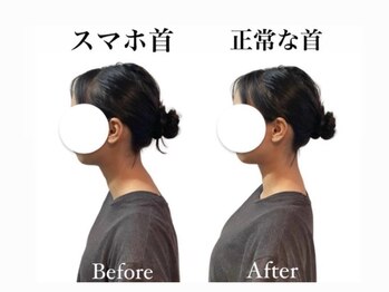 ハリカ 大阪心斎橋店(HARIKA)/スマホ首/肩こりでお悩みの方に