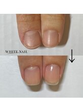 ホワイトネイル 武蔵小杉店(WHITE NAIL)/ネイルケア・自爪育成・爪育