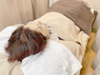 こじま 富雄団地接骨院/ヒト幹細胞美容鍼