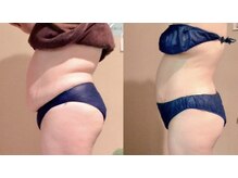 トータルエステ ユキ(YUKI)の雰囲気（貴女の望む結果を二人三脚で手に入れましょう☆）