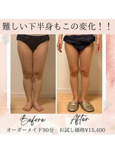 サロン ド ボーテ ラーンジュ 岐阜店(salon de beaut'e L'ange)/ハイパ-ナイフEX2ダイエット痩身