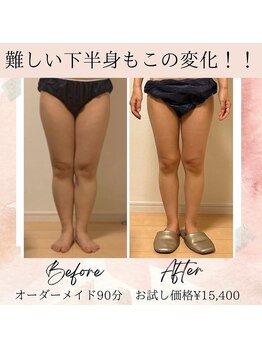 サロン ド ボーテ ラーンジュ 岐阜店(salon de beaut'e L'ange)/ハイパ-ナイフEX2ダイエット痩身