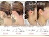 ブラジリアンワックス(うなじ)と光脱毛のハイブリット脱毛 保湿付1回/5000円