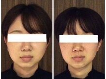 美容整体ウェリナ 名駅院/小顔矯正/骨盤矯正/美脚サロン